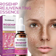 Rosehip rejuvenating essence serum for anti-aging, skin lightening, and wrinkle reduction.